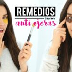 8 remedios para eliminar las ojeras