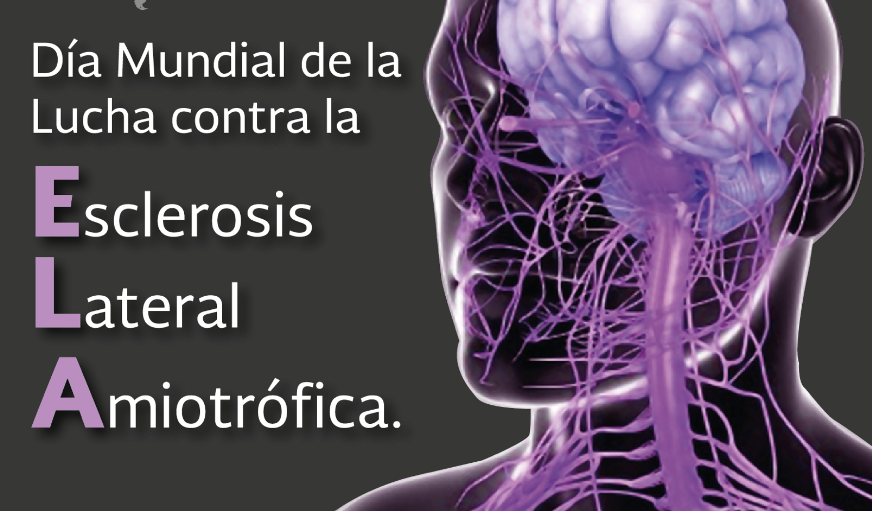 Día Mundial de la ELA, la esclerosis lateral amiotrófica