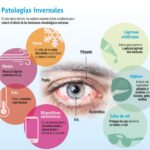 El síndrome del ojo seco. Todo lo que debes saber