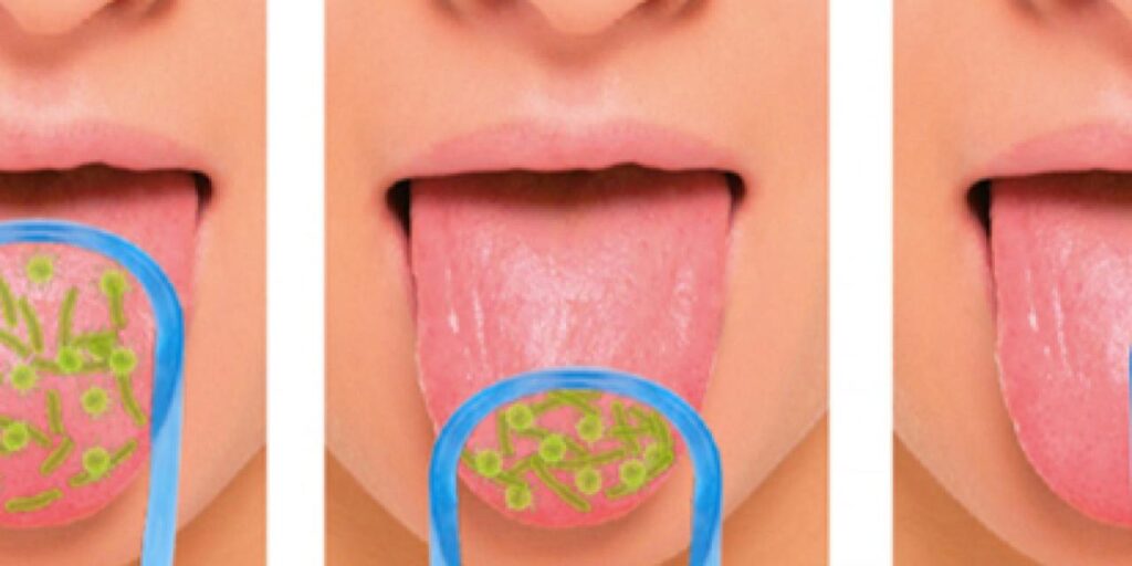 Raspador de lengua: cómo limpiar bien la boca